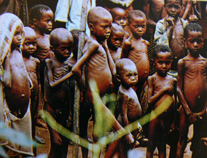 Эфиопские дети с распухшим из-за белково-энергетического голодания, животом в ожидании пищи. 